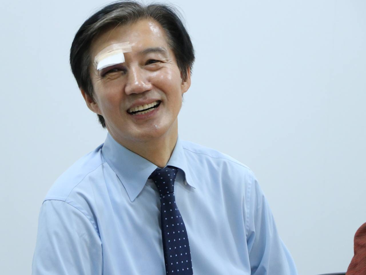 조국 유세 중 부상 공개, 오른쪽 눈 멍에도 “뚜벅이는 계속된다”